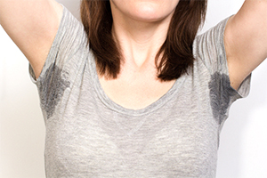 Portland Excessive Sweating Treatment
